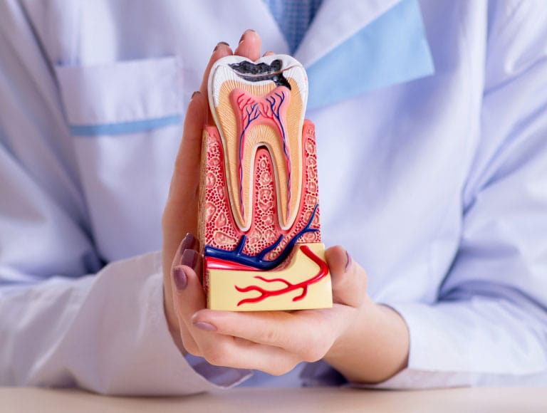 Root Canal Therapy — 123 iSmile Modesto CA